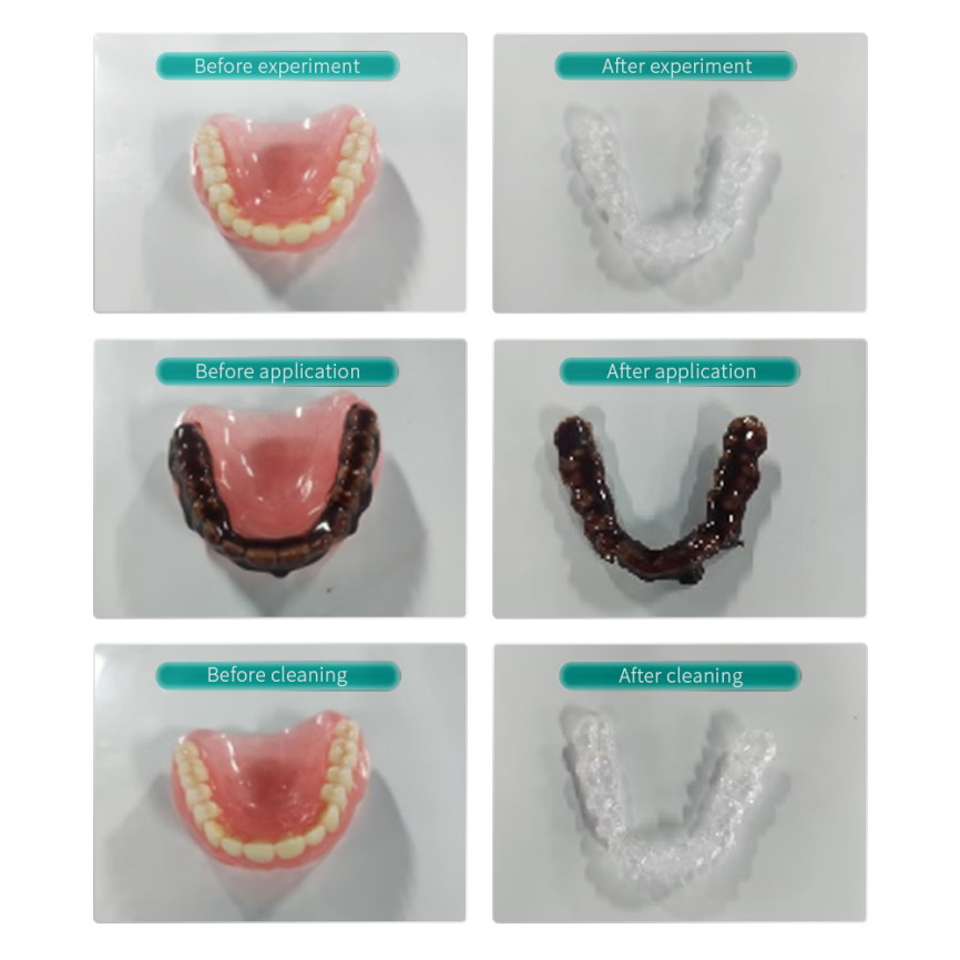 ultrasonic mouthguard cleaner3